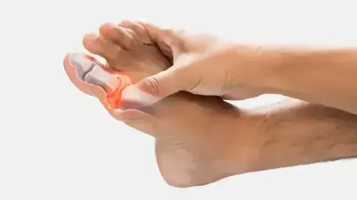 Osteoarthritis Vs. RA (Rheumatoid Arthritis) Vs. Gout: What’s the Difference?